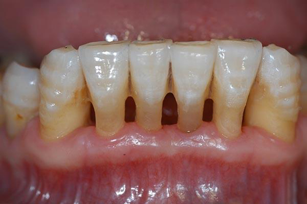 哈密最新24小时牙医在线咨询方法分析(最方便真实的哈密有没有24小时牙医方法)